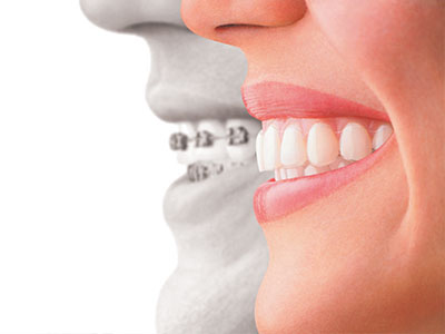 Cameron Park Dental Care | Air Abrasion, Periodontal Treatment and Sedation Dentistry