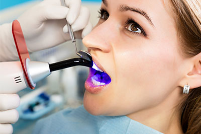 Cameron Park Dental Care | Air Abrasion, Inlays  amp  Onlays and Oral Exams