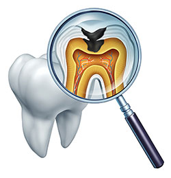 Cameron Park Dental Care | Periodontal Treatment, Dentures and Root Canals