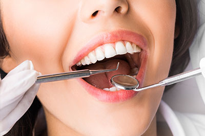 Cameron Park Dental Care | Air Abrasion, Fluoride Treatment and Dentures